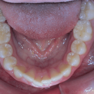 Bandeen Orthodontics Case Studies Development
