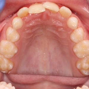 Bandeen Orthodontics Case Studies Development